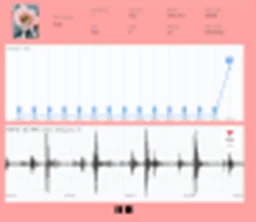 BLE 기반 동물용 청진기 PC 모니터링 - * 이미지