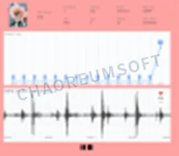 BLE 기반 동물용 청진기 PC 모니터링 - * 이미지